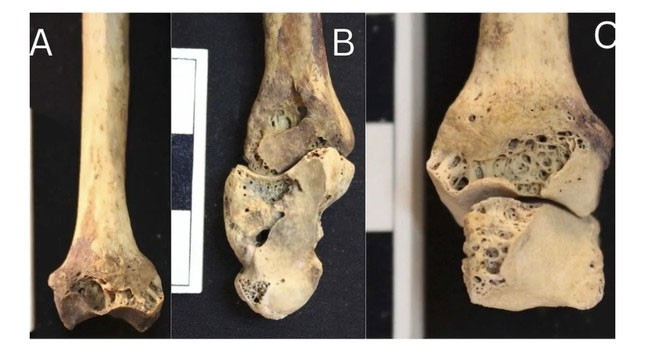 Bộ xương của người phụ nữ hơn 3.500 năm tuổi. (Ảnh: Getty images).